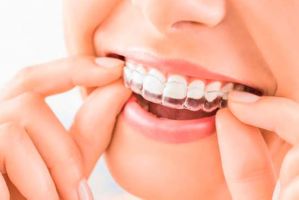 cursos implantologia dental cancun Cosmética Dental Azuna Cancún